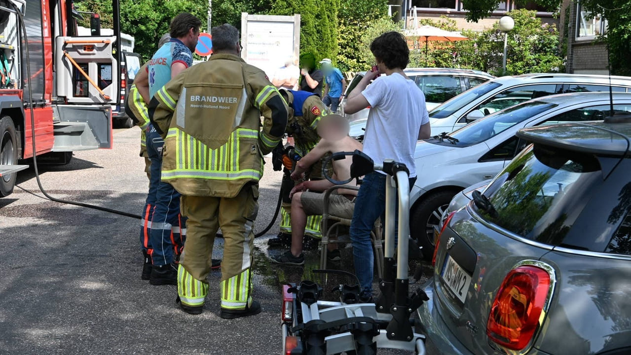 Man loopt zware brandwonden op